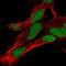 HOXA9 antibody, NBP2-32356, Novus Biologicals, Immunofluorescence image 