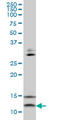 Vesicle-associated membrane protein 1 antibody, LS-C133460, Lifespan Biosciences, Western Blot image 