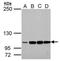 Leucine Rich Repeats And Immunoglobulin Like Domains 3 antibody, PA5-34865, Invitrogen Antibodies, Western Blot image 