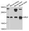 ADP-ribosylation factor-like protein 6 antibody, A8269, ABclonal Technology, Western Blot image 