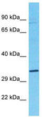 OS9 Endoplasmic Reticulum Lectin antibody, TA335671, Origene, Western Blot image 