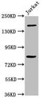 BCL9 Transcription Coactivator antibody, CSB-PA002631LA01HU, Cusabio, Western Blot image 