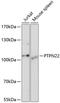 Protein Tyrosine Phosphatase Non-Receptor Type 22 antibody, 15-350, ProSci, Western Blot image 