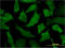 Proliferation-Associated 2G4 antibody, LS-C197833, Lifespan Biosciences, Immunofluorescence image 
