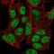 Zinc Finger Protein 556 antibody, NBP2-56019, Novus Biologicals, Immunofluorescence image 
