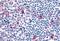 C-C chemokine receptor type 8 antibody, GTX78055, GeneTex, Immunohistochemistry paraffin image 