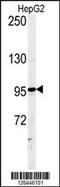 Ataxin 2 Like antibody, 61-826, ProSci, Western Blot image 