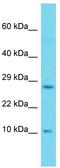 SH2 Domain Containing 1A antibody, TA342927, Origene, Western Blot image 
