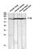 Coagulation Factor XIII B Chain antibody, STJ97654, St John