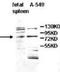 Platelet Derived Growth Factor C antibody, TA310120, Origene, Western Blot image 