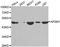 AP2M1 antibody, A2492, ABclonal Technology, Western Blot image 