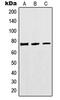 Methylenetetrahydrofolate Reductase antibody, MBS820888, MyBioSource, Western Blot image 