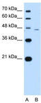 SMAD Family Member 7 antibody, TA329747, Origene, Western Blot image 