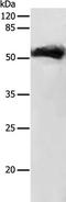 Growth Differentiation Factor 9 antibody, TA322635, Origene, Western Blot image 