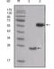 SRC Proto-Oncogene, Non-Receptor Tyrosine Kinase antibody, GTX83021, GeneTex, Western Blot image 
