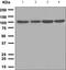 Protein Kinase D1 antibody, ab108963, Abcam, Western Blot image 