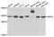 Origin Recognition Complex Subunit 6 antibody, A05558, Boster Biological Technology, Western Blot image 