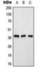 ATPase H+ Transporting Accessory Protein 2 antibody, orb214967, Biorbyt, Western Blot image 