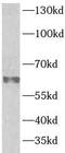 Prosaposin antibody, FNab06843, FineTest, Western Blot image 