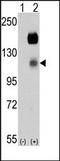 Protein Tyrosine Kinase 7 (Inactive) antibody, AP14595PU-N, Origene, Western Blot image 