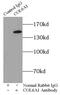 Collagen alpha-1(VI) chain antibody, FNab01846, FineTest, Immunoprecipitation image 