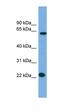 Cysteine-rich hydrophobic domain 1 protein antibody, orb325190, Biorbyt, Western Blot image 