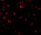 Interleukin 1 Receptor Associated Kinase 1 antibody, 1007, ProSci Inc, Immunofluorescence image 