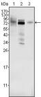 MDM4 antibody, GTX83335, GeneTex, Western Blot image 