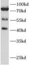 Mitochondrial Antiviral Signaling Protein antibody, FNab10248, FineTest, Western Blot image 