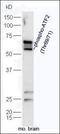 Homer Scaffold Protein 3 antibody, orb4587, Biorbyt, Western Blot image 