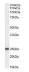 Ornithine Decarboxylase Antizyme 1 antibody, orb373004, Biorbyt, Western Blot image 
