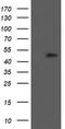 Phosphorylase Kinase Catalytic Subunit Gamma 2 antibody, TA800354BM, Origene, Western Blot image 