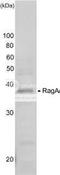 Ras Related GTP Binding A antibody, 71-020, BioAcademia Inc, Western Blot image 