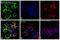 Zeta Chain Of T Cell Receptor Associated Protein Kinase 70 antibody, PA5-17815, Invitrogen Antibodies, Immunofluorescence image 