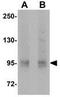 EPH Receptor A10 antibody, GTX85273, GeneTex, Western Blot image 