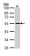 Protein Phosphatase 2 Regulatory Subunit Bbeta antibody, PA5-29262, Invitrogen Antibodies, Western Blot image 