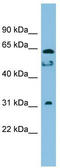 Maestro Heat Like Repeat Family Member 8 antibody, TA337636, Origene, Western Blot image 