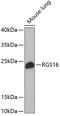 Regulator of G-protein signaling 16 antibody, 19-270, ProSci, Western Blot image 