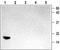 Neurotrophin 3 antibody, TA328680, Origene, Western Blot image 
