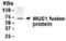 Mucin 1, Cell Surface Associated antibody, XW-8095, ProSci, Immunohistochemistry paraffin image 