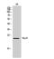 Natural Cytotoxicity Triggering Receptor 3 antibody, STJ97326, St John