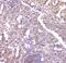 C-C motif chemokine 6 antibody, A30384, Boster Biological Technology, Immunohistochemistry paraffin image 