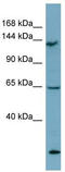 WARTS antibody, TA344386, Origene, Western Blot image 