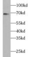 Zeta Chain Of T Cell Receptor Associated Protein Kinase 70 antibody, FNab09582, FineTest, Western Blot image 