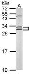 Nitric Oxide Synthase Interacting Protein antibody, GTX116126, GeneTex, Western Blot image 