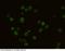 Interleukin 2 Receptor Subunit Gamma antibody, 50087-R011, Sino Biological, Immunohistochemistry frozen image 