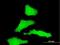 Ras-related protein Rab-31 antibody, H00011031-M03, Novus Biologicals, Immunofluorescence image 
