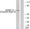 ADAM 17 antibody, TA326296, Origene, Western Blot image 