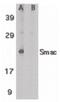 Diablo IAP-Binding Mitochondrial Protein antibody, PA5-19974, Invitrogen Antibodies, Western Blot image 