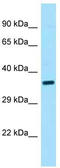 PBIP1 antibody, TA342607, Origene, Western Blot image 